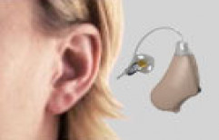 Receiver in The Canal Hearing Aids by SAN InventiveSolutions Pvt. Ltd.