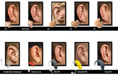 Hearing Aids by SP Hear Cochlear