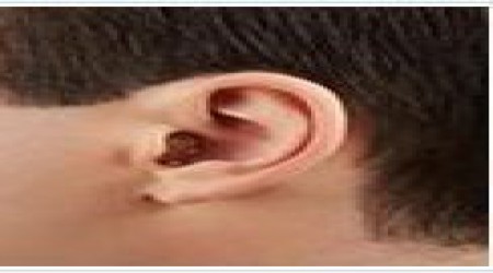 Siemens Insio 3mi CIC Hearing Aid by Shrobonee Hearing Aid Center