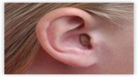 Hearing Aids by Special Ear Nose Throught Hospital