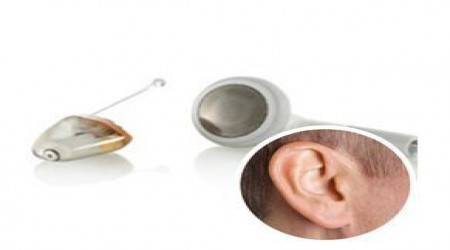 Invisible In Canal Hearing Aid by Harmony Speech & Hearing Clinic