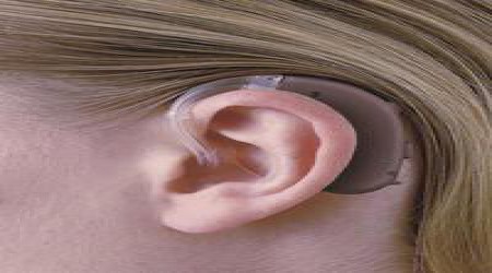 Behind The Ear Hearing Aid by Siemens Bestsound Hearing Aid Center - Shrobonee