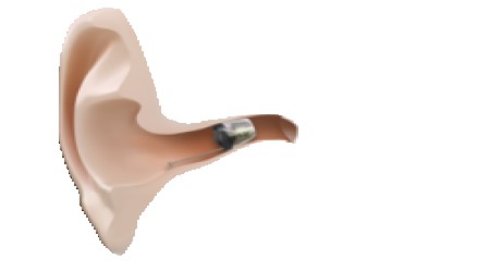 Oticon Invisible In Canal Hearing Aids by Karn Dhwani Enterprises