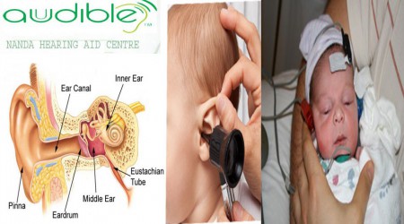 Hearing Aid by Audible Hearing Aid Centre